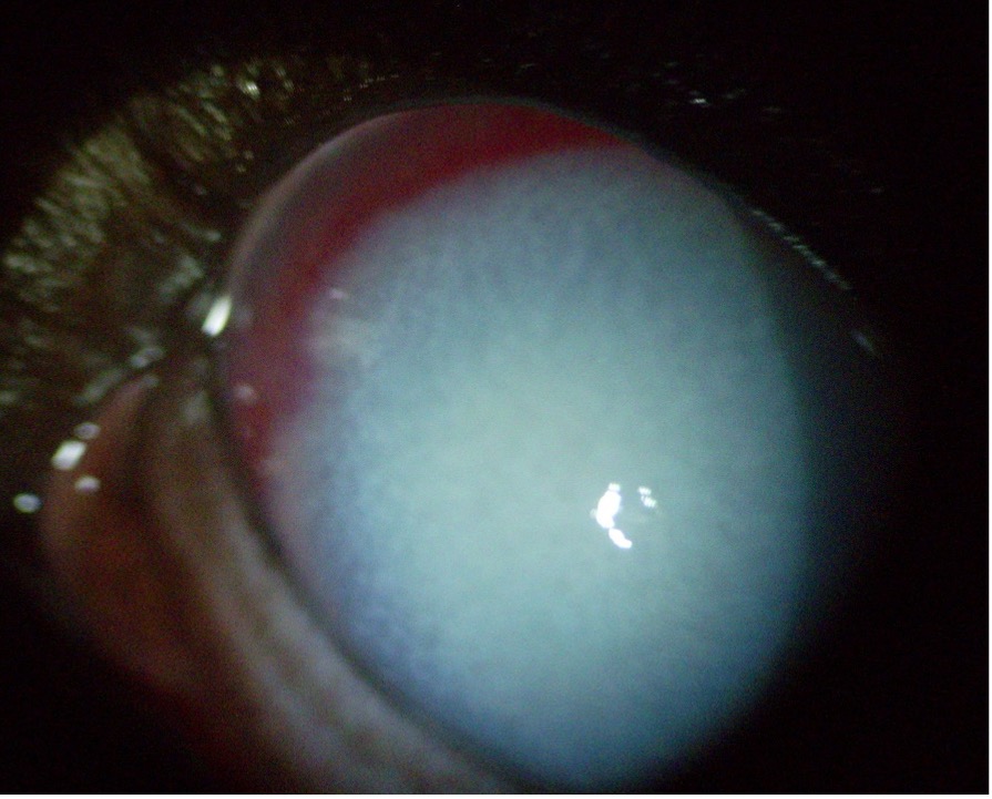 zöldhályog kutya szem